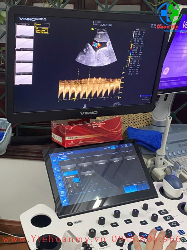 M&aacute;y si&ecirc;u &acirc;m 5D Vinno S300